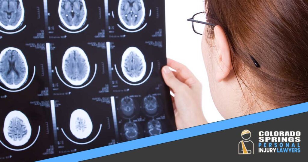 Colorado Springs Traumatic Brain Injury Attorneys